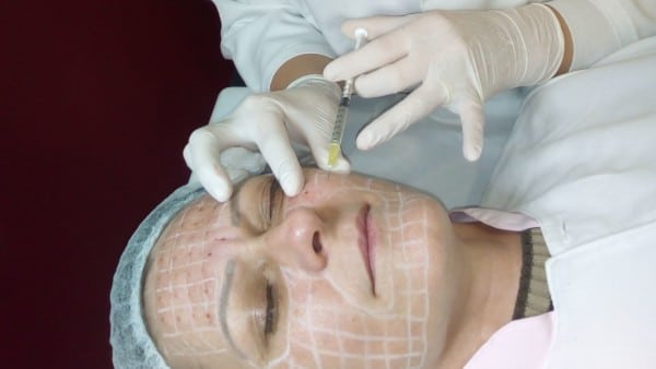 Aplicação Facial - Intradermoterapia