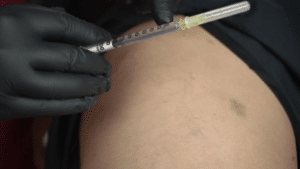 Curso PEIM Microvasos Online