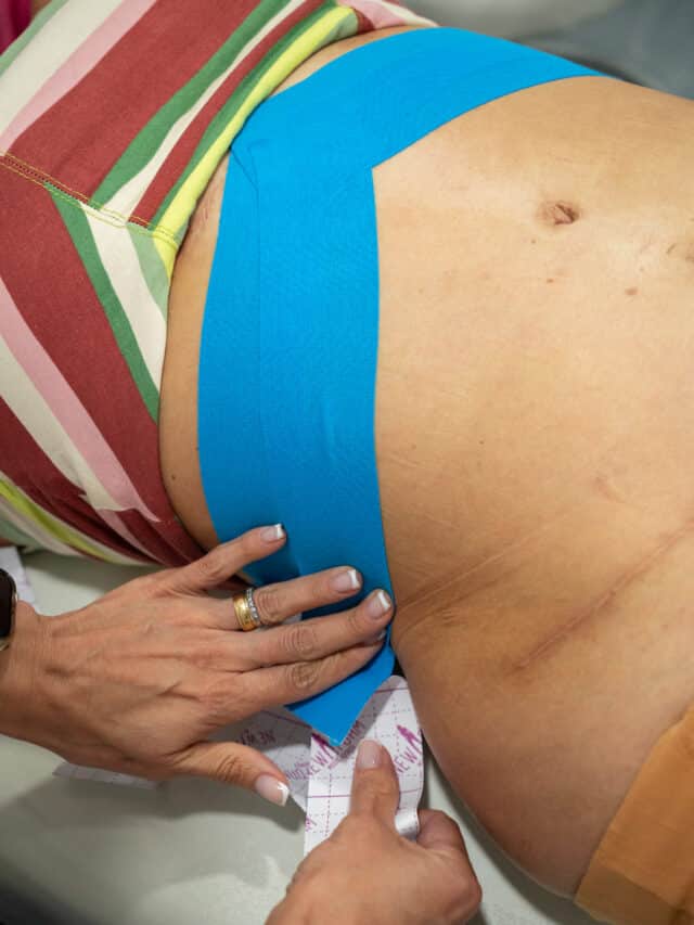 Taping pós-operatório