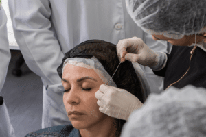 Curso Fios PDO Facial