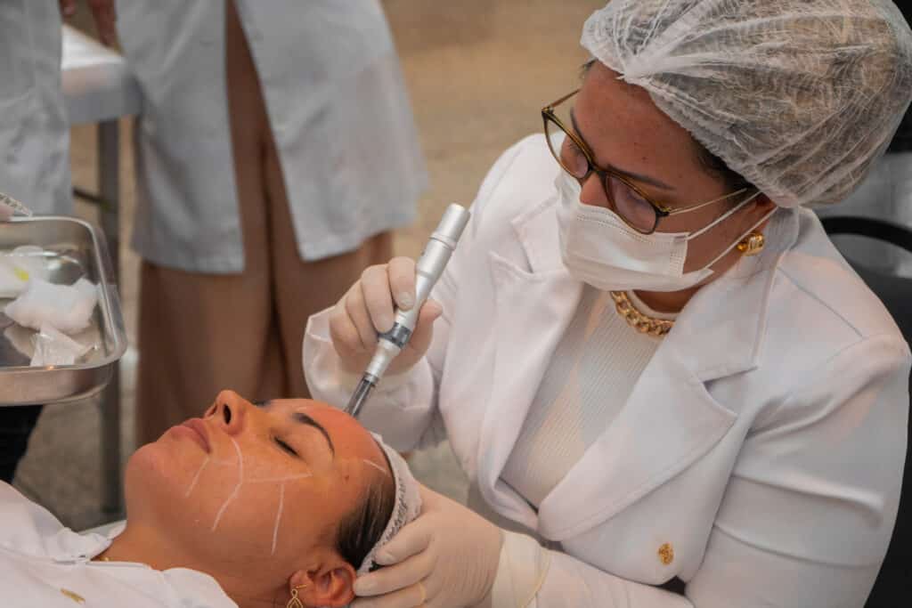 Vivencia Clinica microagulhamento 2