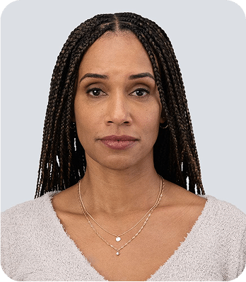 6 preenchimeto facial