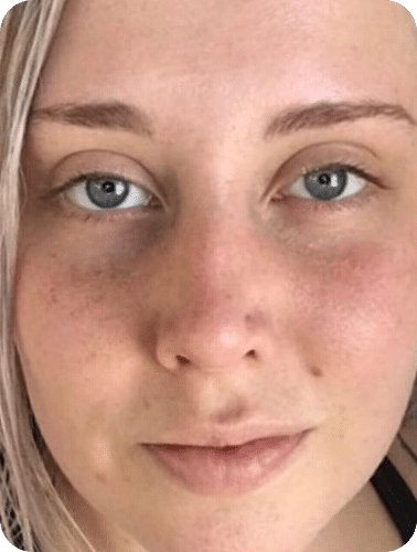 PRP & PRF | Plasma Rico em Plaquetas ou Fibrina - Goiânia 27 6PRP