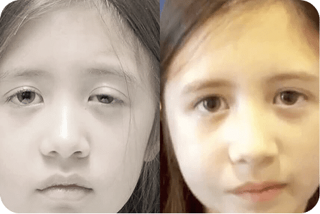 Ozonioterapia Estética Avançada - Florianópolis 20 6ozonioterapia