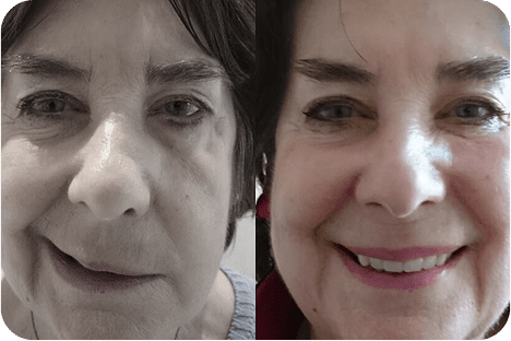 Ozonioterapia Estética Avançada - Florianópolis 21 7ozonioterapia