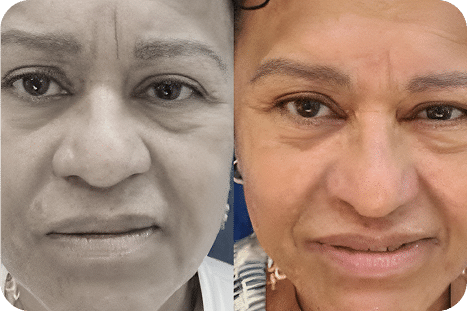 Ozonioterapia Estética Avançada - Florianópolis 19 8ozonioterapia