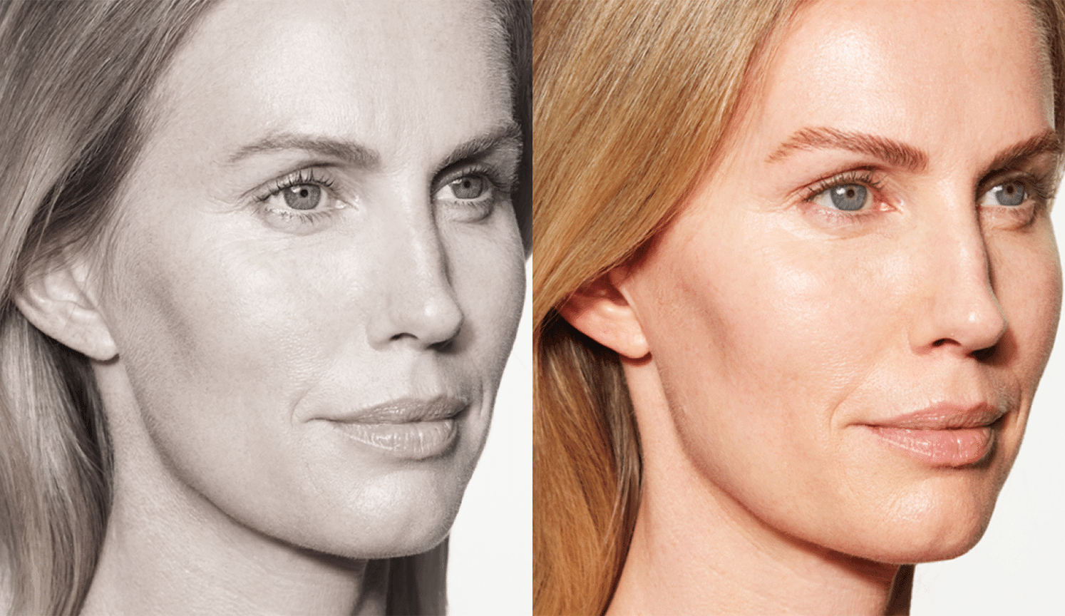 Chole-Antes e Depois