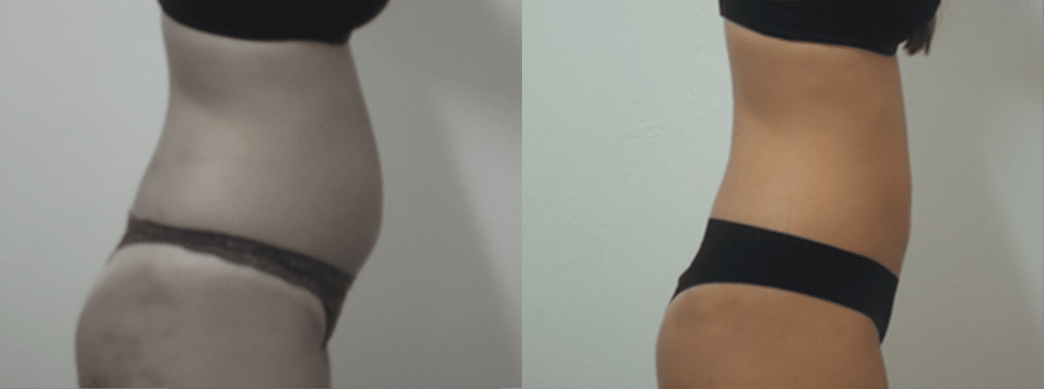 Corrente Russa-5