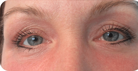 DSC03965-scaled-1 CARBOX