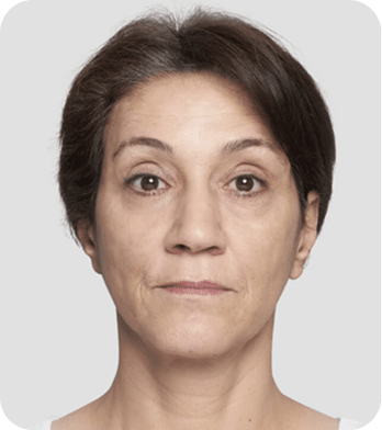 DSC03965-scaled-1 fios de sustentação