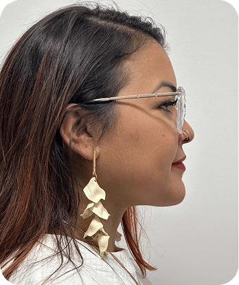 DSC03965-scaled-1LIPO PAPADA