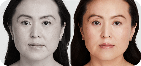 Ultrassom Estético e Microfocado - Salvador 20 DSC03965-scaled-1UKLTRASSOM