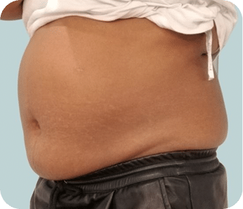 DSC03965-scaled-1ULTRACAV