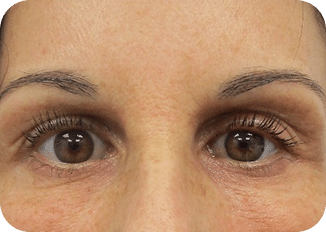 DSC04262-scaled-1 CARBOX