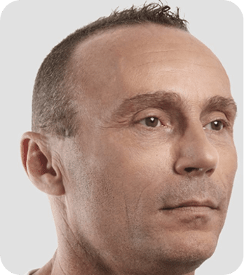 DSC04262-scaled-1 fios de sustentação