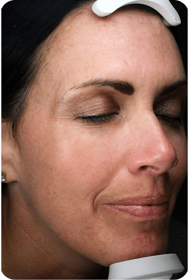 Lavieen | Laser de BB Glow Coreano - Florianópolis 23 DSC04262-scaled-1LAVIEENN