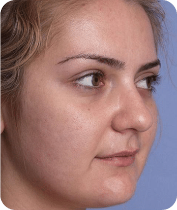 LED Terapia | Fototerapia Facial - Rio de Janeiro 24 DSC04262-scaled-1LED -3