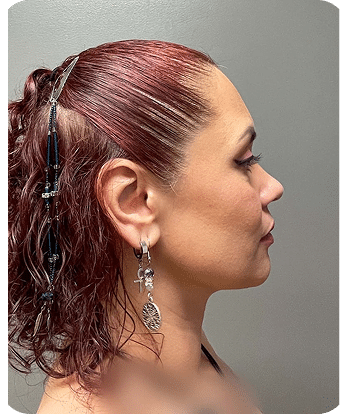 DSC04262-scaled-1LIPO PAPADA