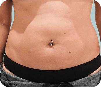 DSC04262-scaled-1ULTRACAV