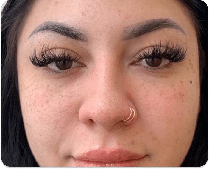 DSC04779 scaled 1 1 ELETROCAUTERIO