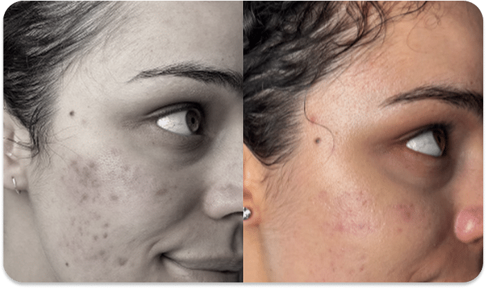 DSC04779 scaled 1 1 LED