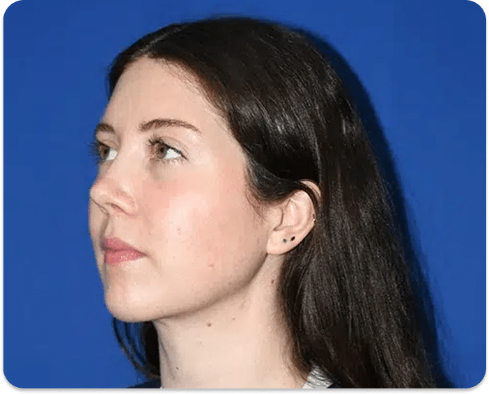 DSC04779 scaled 1 1 LIPO DE PAPADA