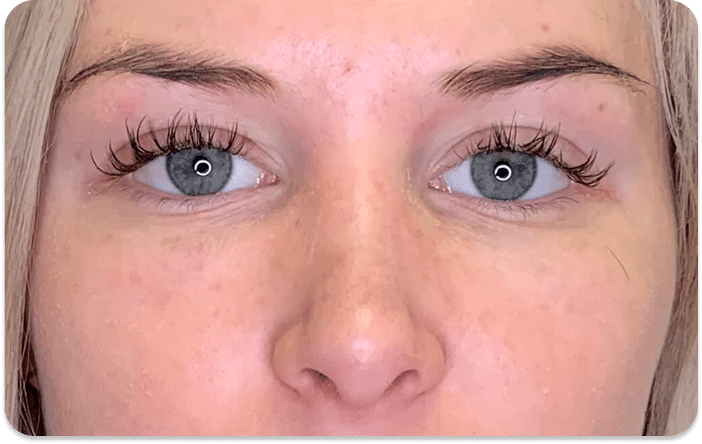 DSC04779 scaled 1 1 PRP