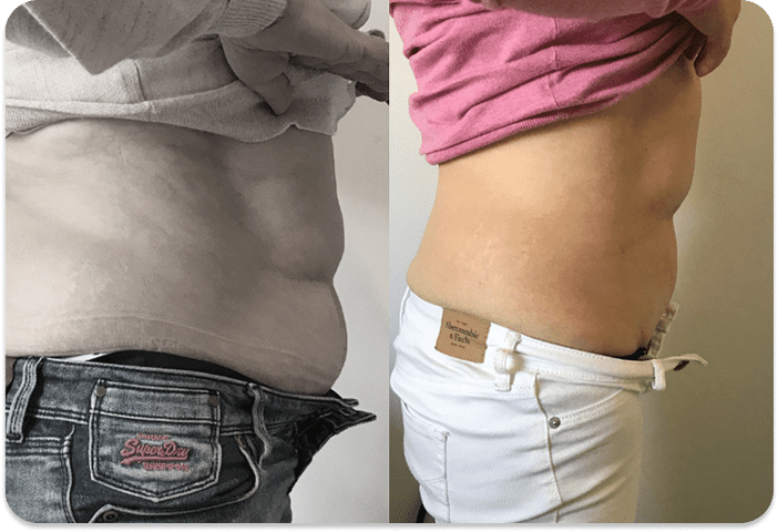 DSC04779 scaled 1 1 ULTRACAVITACAO