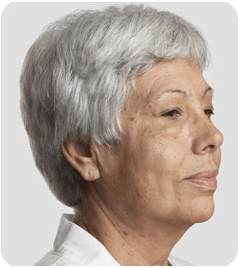 DSC04779-scaled-1 (1) fios de sustentação