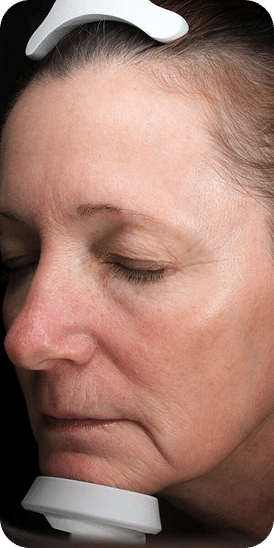 Lavieen | Laser de BB Glow Coreano - Florianópolis 24 DSC04779-scaled-1 (1)LAVIEENN