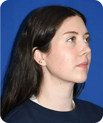 DSC04779-scaled-1 (1)LIPO PAPADA