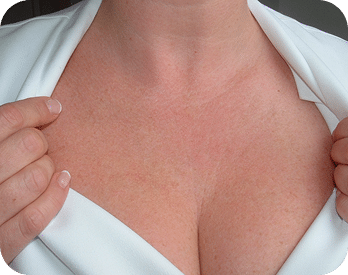 Microagulhamento | Derma Pen & Roller 22 DSC04779-scaled-1 (1)MICROAGULHAMENTO