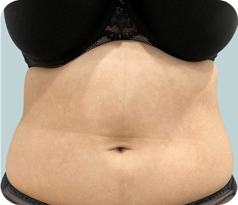 DSC04779-scaled-1 (1)ULTRACAV