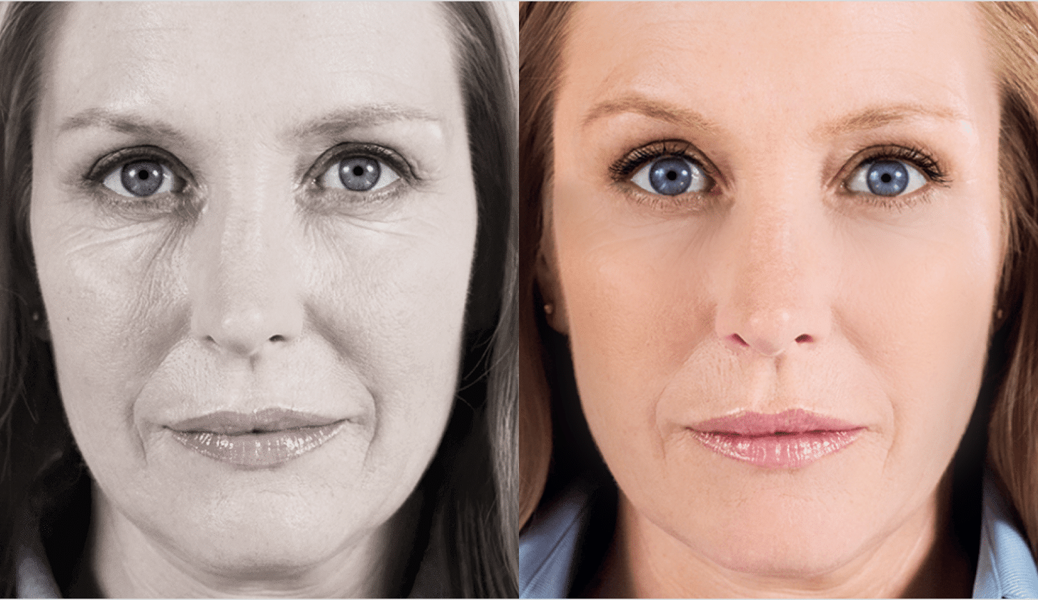 Elissa-Antes e Depois