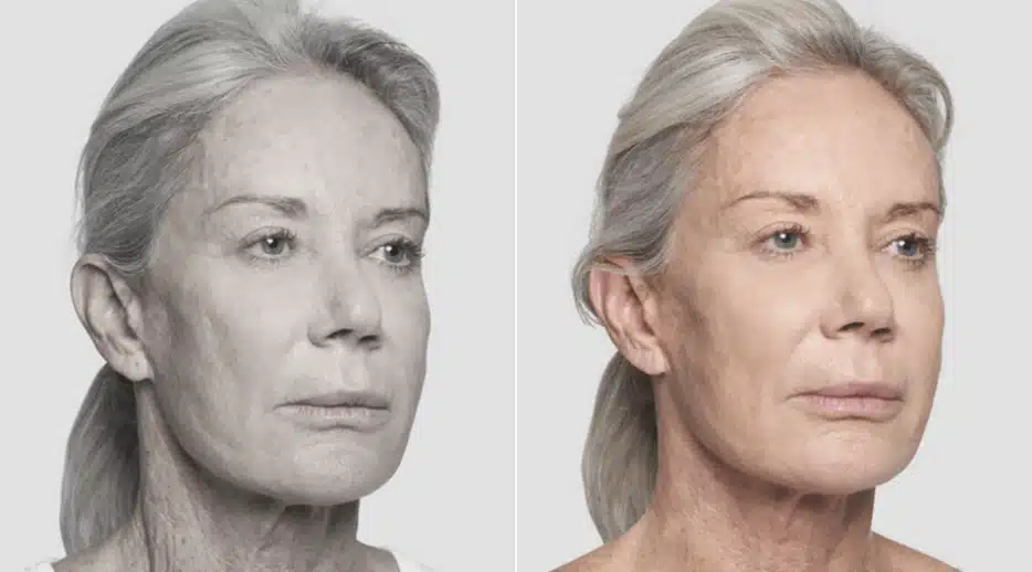 Fios-de-sustentacao-1