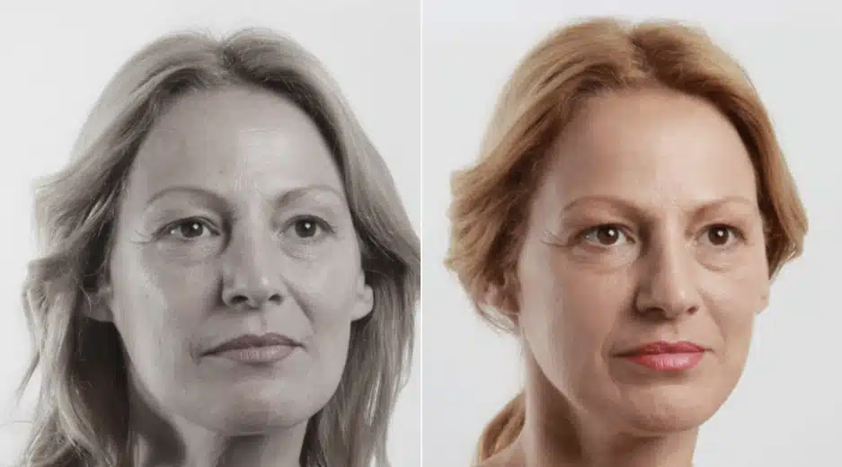 Fios-de-sustentacao-2