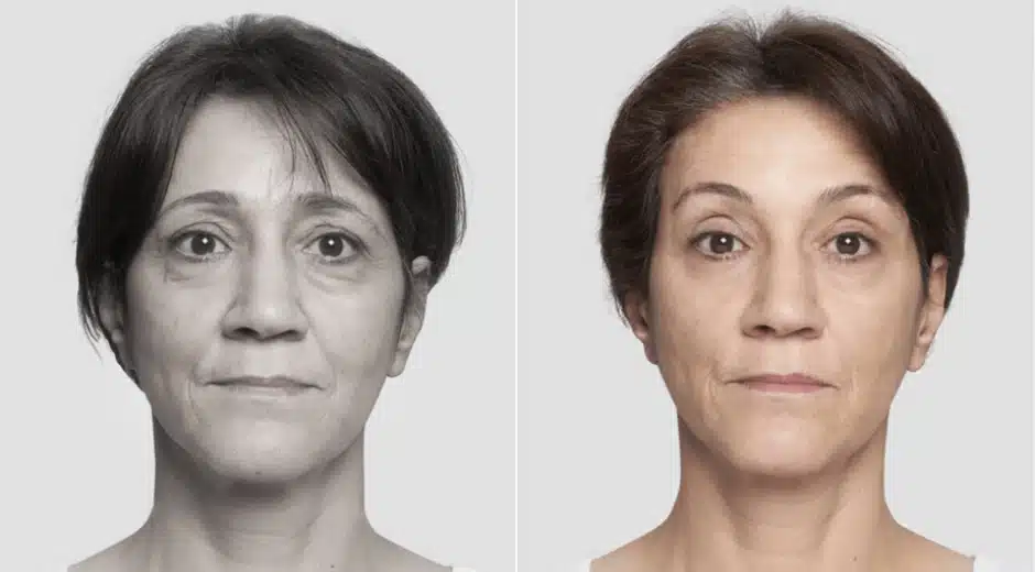 Fios-de-sustentacao-3