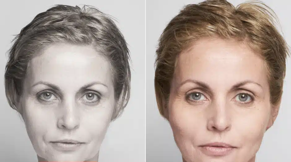 Fios-de-sustentacao-4