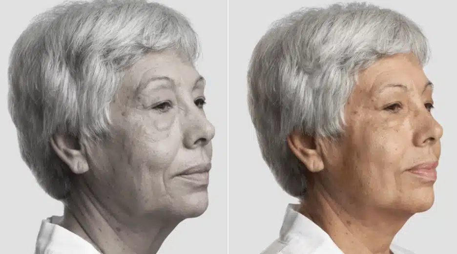 Fios-de-sustentacao-5