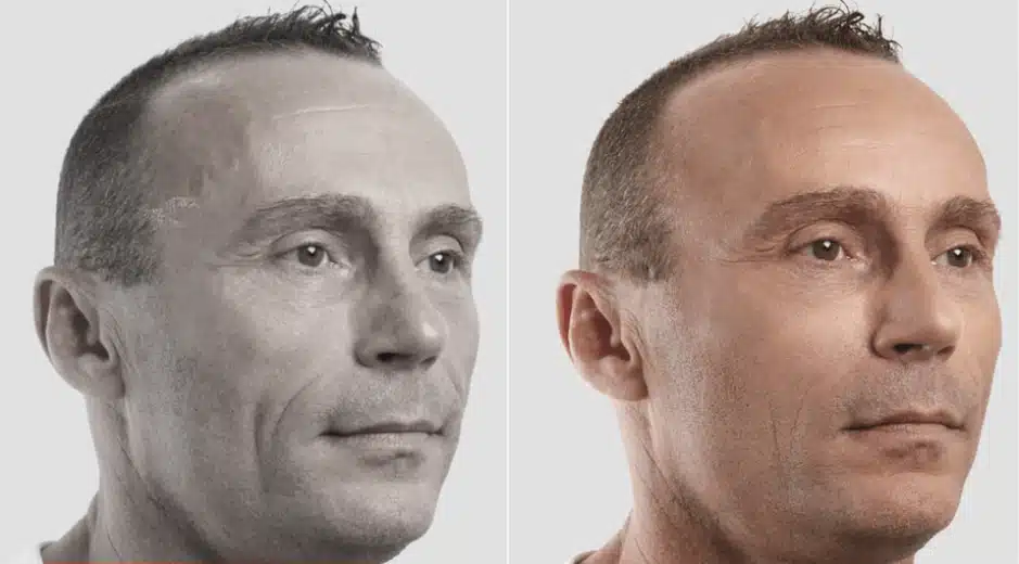 Fios-de-sustentacao-6