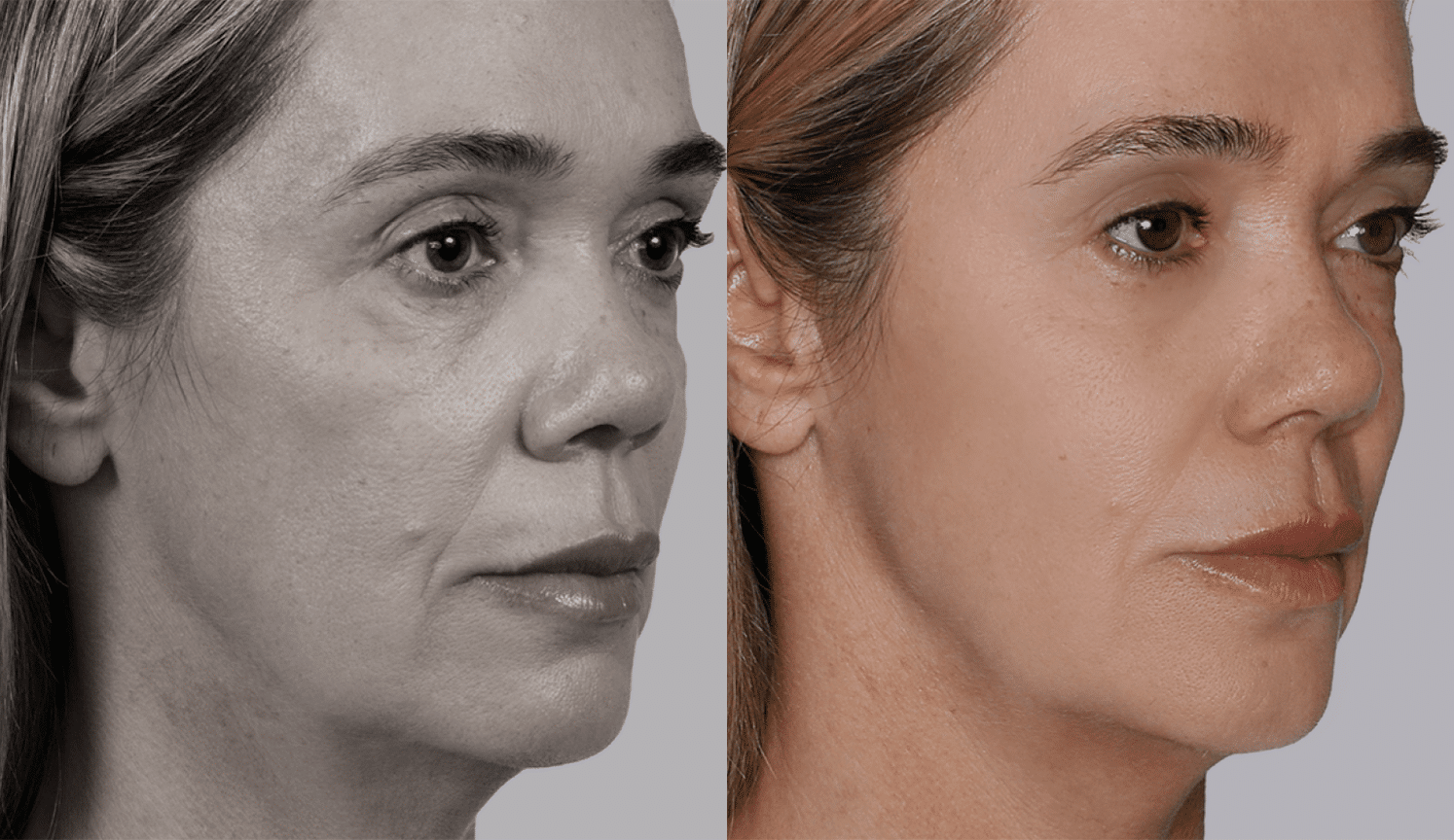 Flavia-Antes e Depois