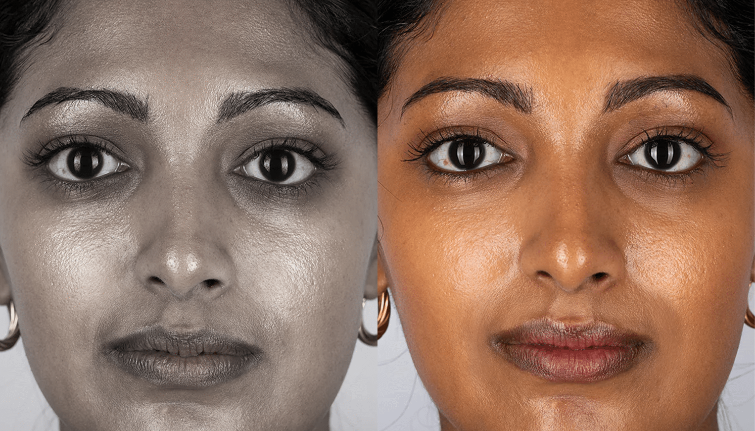 LED Terapia | Fototerapia Facial - Rio de Janeiro 16 LED Terapia-10