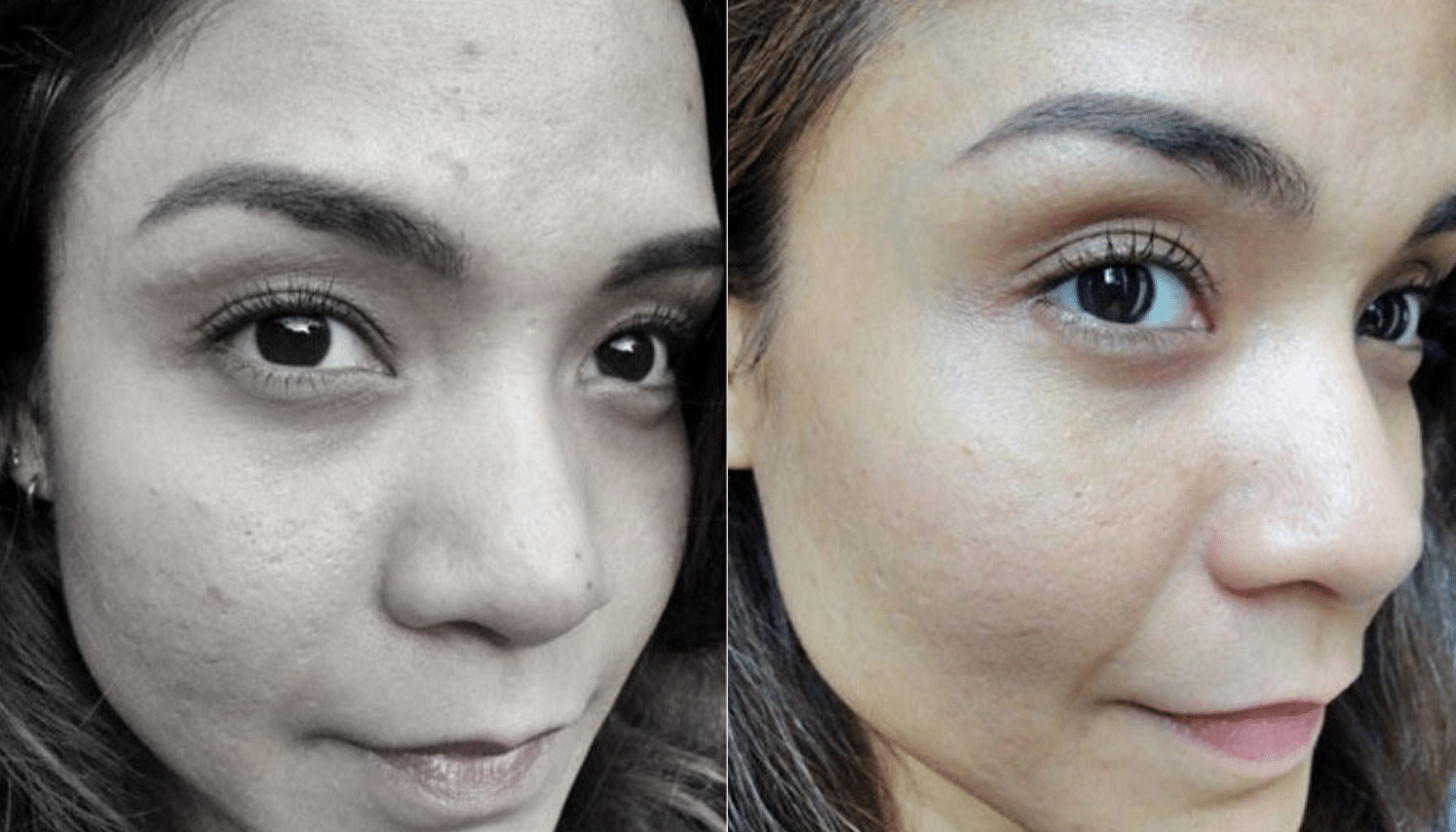 LED Terapia | Fototerapia Facial - Rio de Janeiro 8 LED Terapia-2