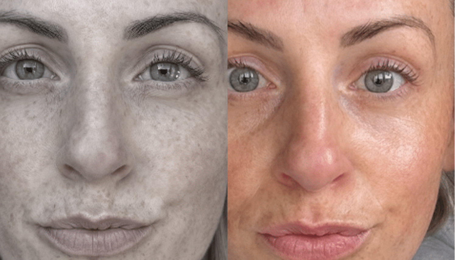 LED Terapia | Fototerapia Facial - Rio de Janeiro 13 LED Terapia-7