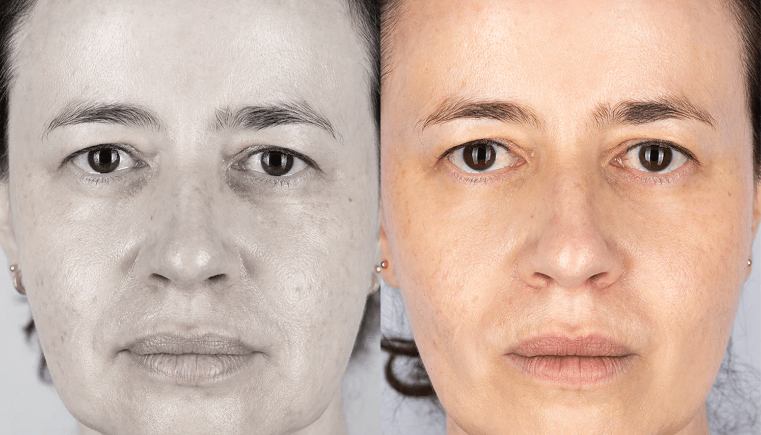 LED Terapia | Fototerapia Facial - Rio de Janeiro 15 LED Terapia-9