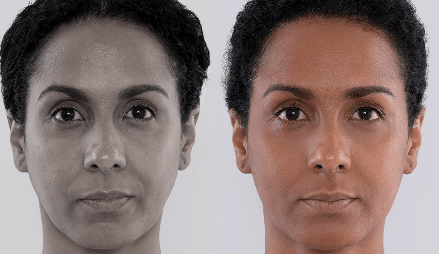 Maria-Antes e Depois