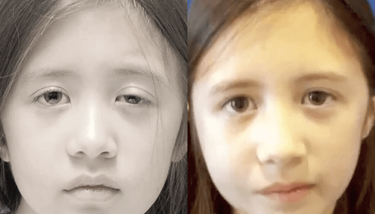 Ozonioterapia Estética Avançada - Florianópolis 11 Ozonioterapia-5