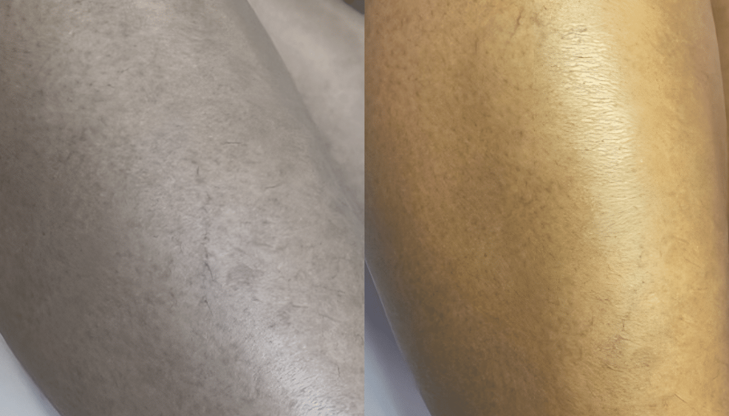 PEIM | Tratamento de Microvasos - Salvador 7 Ozonioterapia