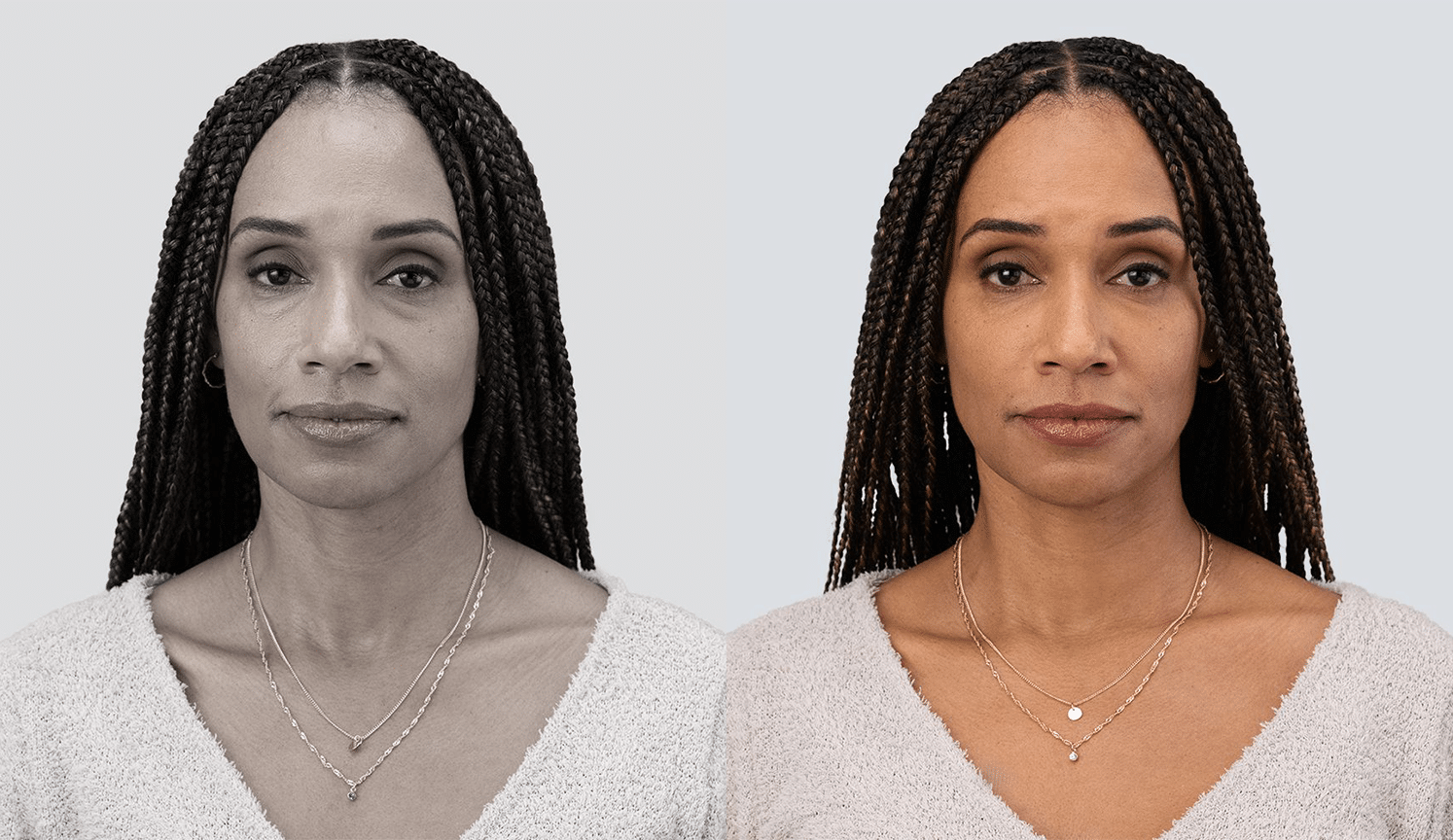PreechimentoF-Antes e Depois