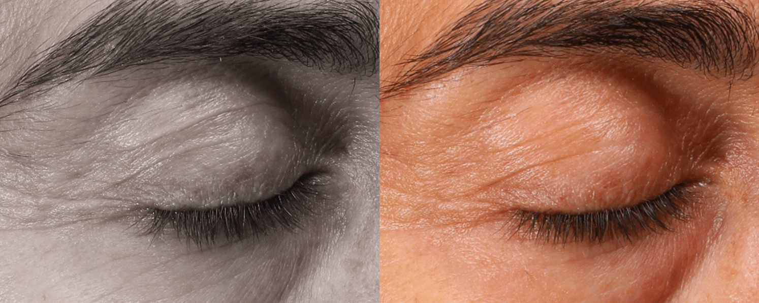 Radiofrequência Corporal e Facial - São Paulo 12 Radiofrequencia-6